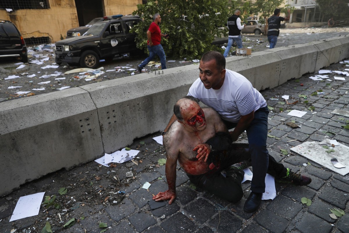 Hassan Ammar, Hussein Malla and Felipe Dana of Associated Press - The  Pulitzer Prizes
