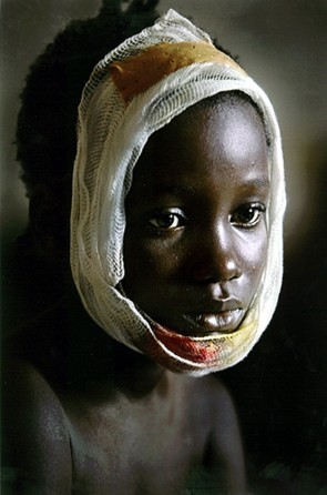 CAUGHT IN THE CONFLICT: Kinny Kanneh, age 9, was wounded when mortar rounds landed in a Monrovia refugee camp run by the American embassy. Refugees descended on the capital to avoid fighting, but the violence followed. (Carolyn Cole)