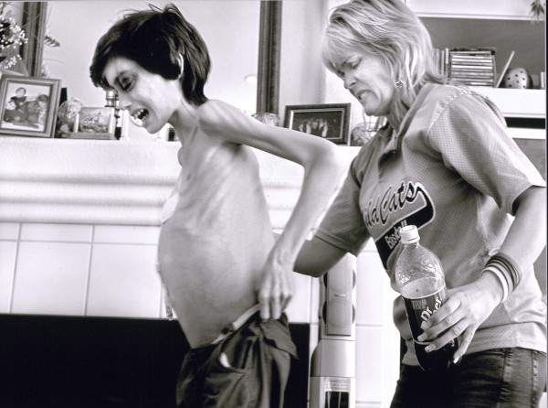 Derek has a final burst of energy after days of Cyndie keeping vigil at his bedside. She helps her anguished son walk on April 26. A cancerous tumor has distended Derek's stomach so far that his pants no longer fit. Another tumor in his brain impairs his eyesight making navigation difficult inside their rental home.