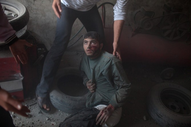 An injured man moments after three bombs exploded in Gaza City, killing one and injuring several others. (November 17, 2012)