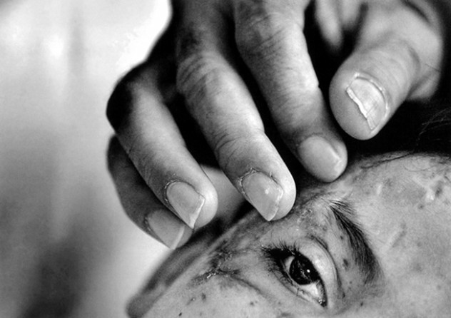 Saleh Khalaf, a 9-year-old Iraqi boy, was severely maimed by an explosion. His indomitable spirit -- which earned Saleh the nickname Lion Heart -- moved Air Force surgeons in Iraq to launch an international mercy mission to save him. Throughout the ordeal Saleh's father, Raheem, stayed at the boy's side, ready with a comforting touch like this.