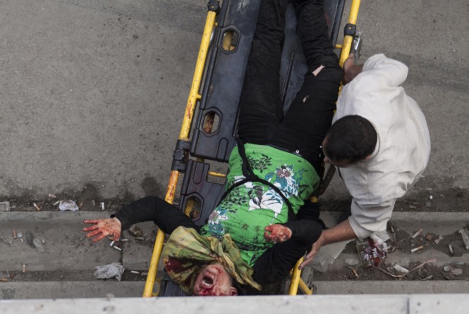 A Syrian man wheels a severely injured woman to a hospital for treatment after an artillery shell landed near a bakery in Aleppo, Syria, Oct. 23, 2012. (Narciso Contreras, Associated Press - October 23, 2012)