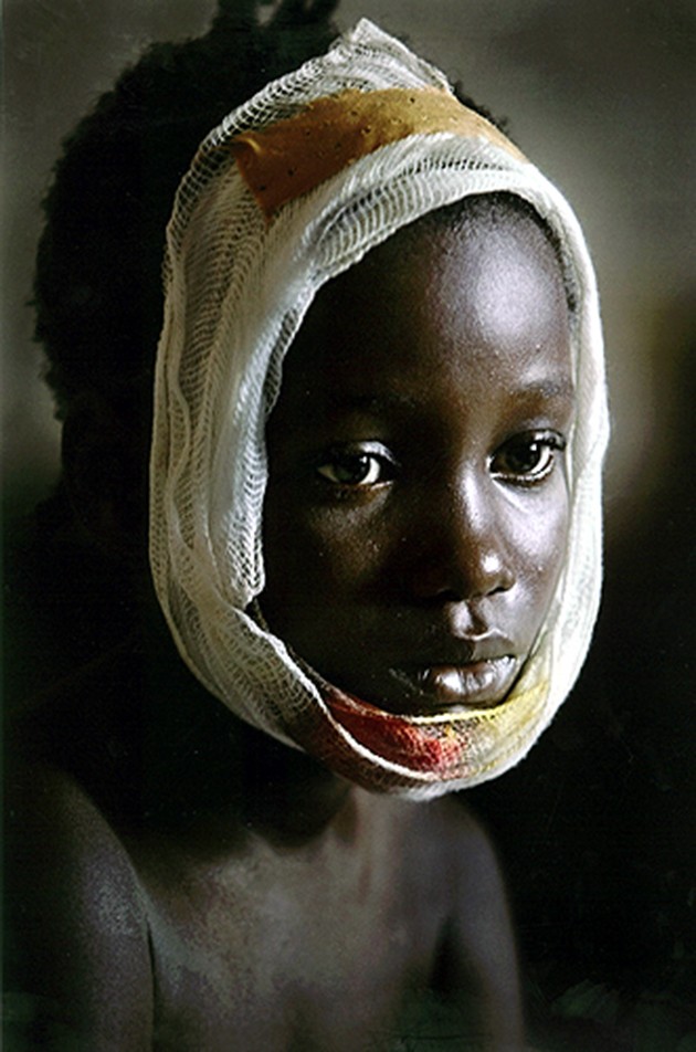 CAUGHT IN THE CONFLICT: Kinny Kanneh, age 9, was wounded when mortar rounds landed in a Monrovia refugee camp run by the American embassy. Refugees descended on the capital to avoid fighting, but the violence followed. (Carolyn Cole)