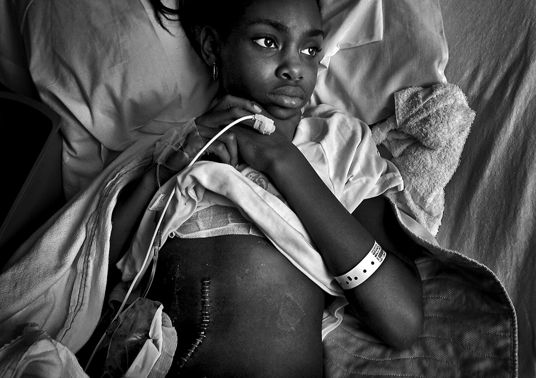 Ten-year-old Erica Miranda was shot three times in the back, knee and hip while playing basketball outside her home in Compton. A young man had walked up to the crowded street corner and started firing a handgun in what police believe was a gang assault. A 17-year-old relative and a 45-year-old family friend, both men, were also shot three times and survived. At Long Beach Memorial Medical Center: Miller Children’s Hospital, Erica waits for her bandage to be changed. (Barbara Davidson, Los Angeles Times - D