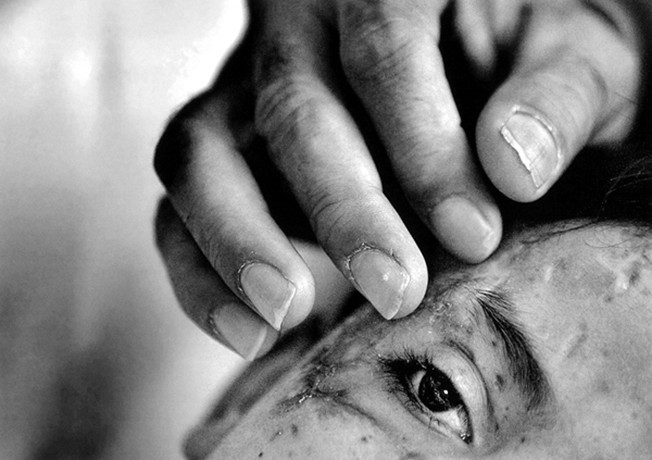 Saleh Khalaf, a 9-year-old Iraqi boy, was severely maimed by an explosion. His indomitable spirit -- which earned Saleh the nickname Lion Heart -- moved Air Force surgeons in Iraq to launch an international mercy mission to save him. Throughout the ordeal Saleh's father, Raheem, stayed at the boy's side, ready with a comforting touch like this.