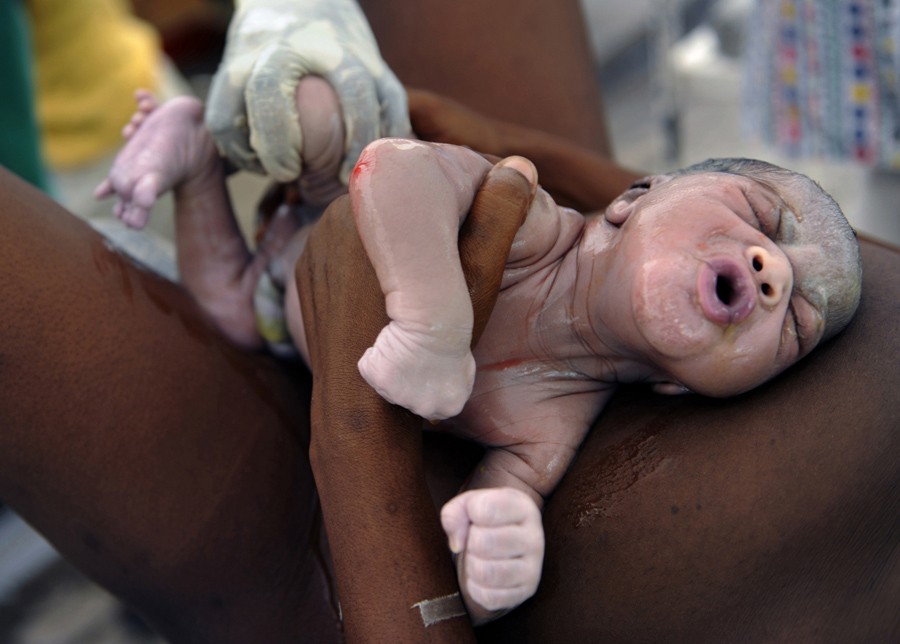 'Life Goes On'  A tiny new life emerges as Destiny Ariel Dorival grimaces at her mother, Nehemie Hilaire, 39, minutes after being born in a makeshift tent serving as a maternity unit at the General Hospital in Port-au-Prince. Nearly half of Haiti's population is younger than 18 years old. Even in better times, many of this country's youth were in desperate need of aid (Nikki Kahn, The Washington Post - March 16, 2010)